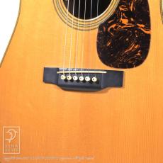 Martin D-28 75th Anniversary Edition _14