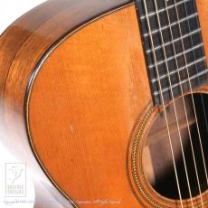 Martin 000-21 (Jacaranda)_10