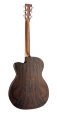 Martin 《限定生産》OMC-X2E Ziricote Special【エレアコ】【未展示品】【ローン金利0%】_3