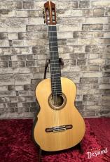 グオ・ユーロン　Guo Yulong Concert特注モデル　松ダブルトップ 2018年製_2